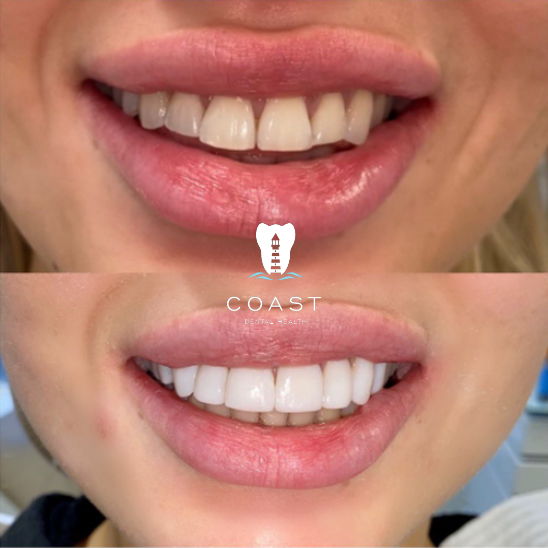 What It Costs Coast Dental Health